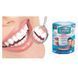 Знімні вініри Perfect Smile Veneers, вініри для зубів, накладні зуби, накладки для зубів 00014584 фото 6