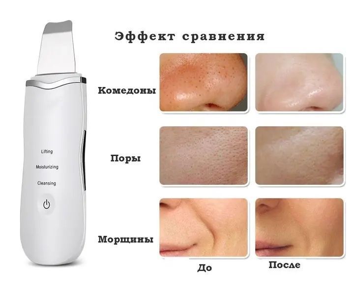 Апарат для ультразвукового чищення обличчя Ultrasonic Shovel 00014761 фото