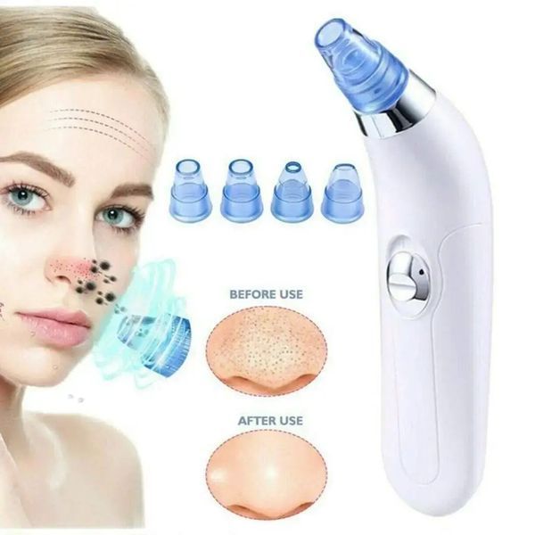 Вакуумный очиститель Derma suction DS Vacuum для профессиональной чистки кожи и пор лица - легкий компактный удобный прибор в использовании + 4 насадки, Белый 00014764 фото