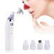 Вакуумный очиститель Derma suction DS Vacuum для профессиональной чистки кожи и пор лица - легкий компактный удобный прибор в использовании + 4 насадки, Белый 00014764 фото 3