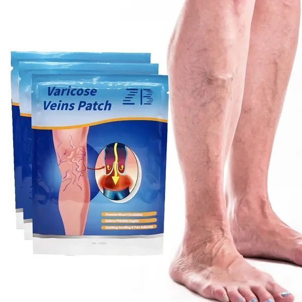 Пластырь от варикоза varicose veins patch 00015626 фото