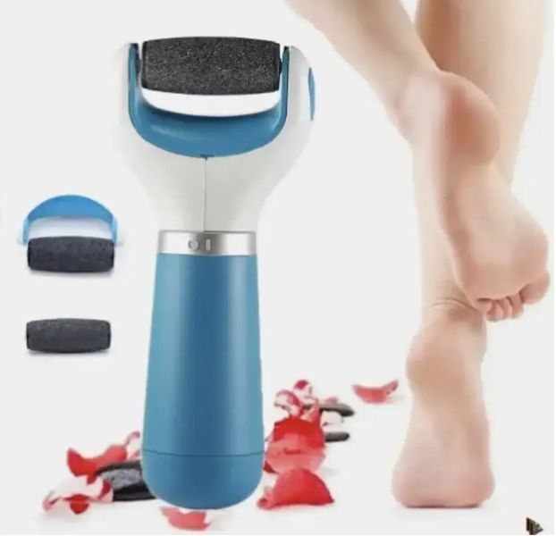 Електрична пилка для ніг Cordress Electric Callus Remover 00021544 фото