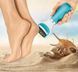 Електрична пилка для ніг Cordress Electric Callus Remover 00021544 фото 2
