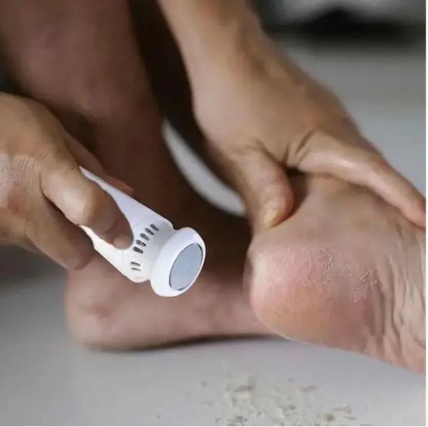 Пемза електрична FOOT GRINDER 928-3 для ніг та п'ят з насадками 00021855 фото