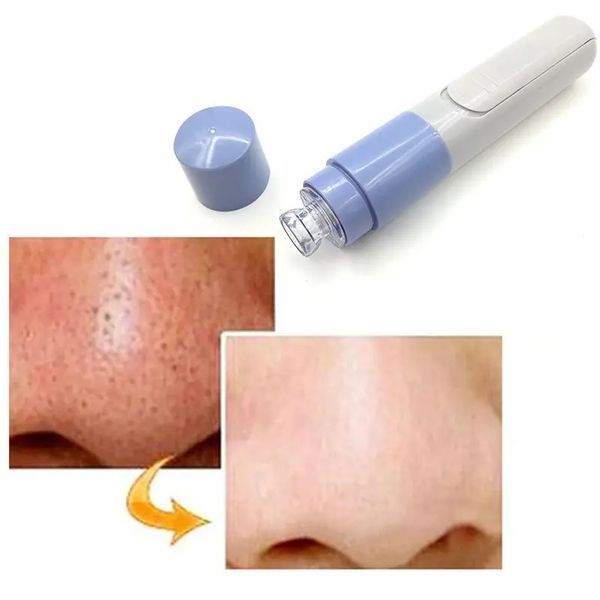 Вакуумний очищувач пор Pore Cleaner 00014605 фото