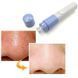 Вакуумний очищувач пор Pore Cleaner 00014605 фото 2