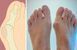 Магнитная вальгусная шина relax foot (magnet fix) магнитный корректор стопы 00015555 фото 6
