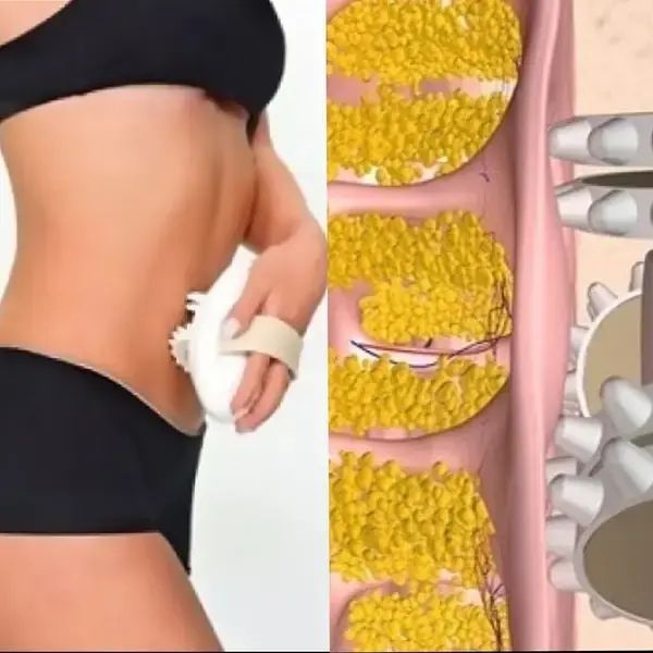Массажер антицеллюлитный Shuqin Body Slimmer SQ 100 00014661 фото