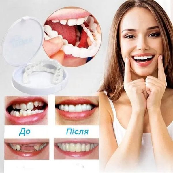 Виниры для зубов верх Snap On Smile 00015046 фото