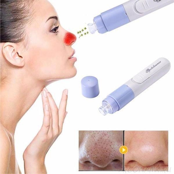 Вакуумний очищувач SPOTCLEANER Face Pore Cleaner вакуумний очищувач пор обличчя 00014381 фото