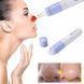 Вакуумний очищувач SPOTCLEANER Face Pore Cleaner вакуумний очищувач пор обличчя 00014381 фото 2